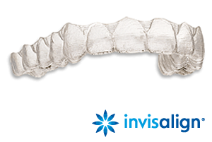 Invisalign Kosten Alpen